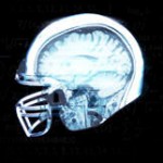 Concussion helmet